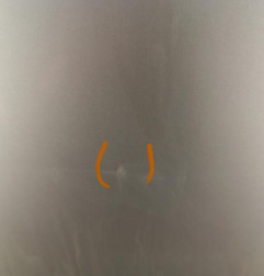 Capot DACIA SANDERO 1