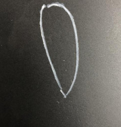 Capot MERCEDES CLASSE B 246 Photo n°5