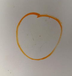 Capot RENAULT CLIO 2