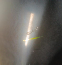 Capot BMW SERIE 3 E91