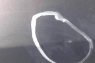 Porte arriere gauche MAZDA 5 1